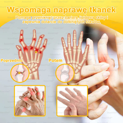 𝑺𝒕𝒂𝒘𝑽𝒊𝒕𝒂𝒍® Krem z jadem pszczelim na regenerację stawów 🏃‍♀️ (ekstrakt z pszczoły nowozelandzkiej – opracowany z myślą o osobach z problemami ze stawami i bólem stawów)