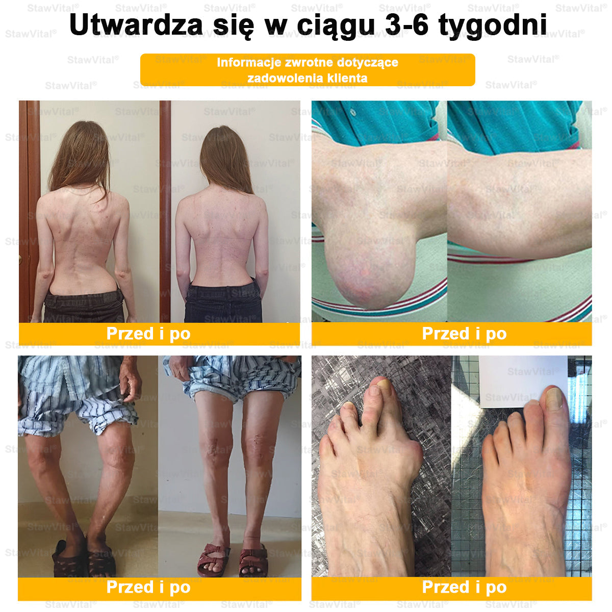 𝑺𝒕𝒂𝒘𝑽𝒊𝒕𝒂𝒍® Krem z jadem pszczelim na regenerację stawów 🏃‍♀️ (ekstrakt z pszczoły nowozelandzkiej – opracowany z myślą o osobach z problemami ze stawami i bólem stawów)