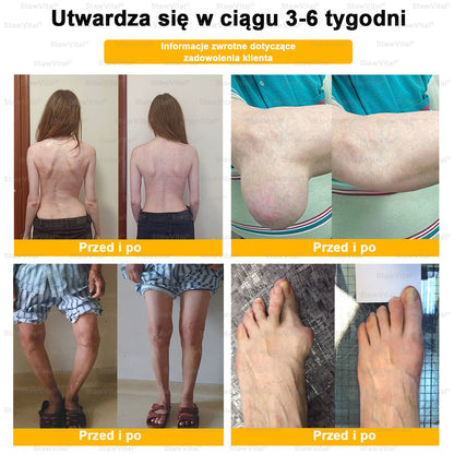 𝑺𝒕𝒂𝒘𝑽𝒊𝒕𝒂𝒍® Krem z jadem pszczelim na regenerację stawów 🏃‍♀️ (ekstrakt z pszczoły nowozelandzkiej – opracowany z myślą o osobach z problemami ze stawami i bólem stawów)