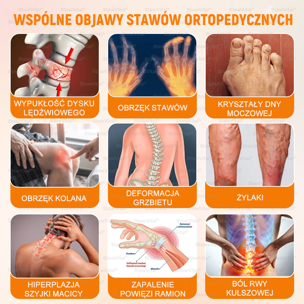 𝑺𝒕𝒂𝒘𝑽𝒊𝒕𝒂𝒍® Krem z jadem pszczelim na regenerację stawów 🏃‍♀️ (ekstrakt z pszczoły nowozelandzkiej – opracowany z myślą o osobach z problemami ze stawami i bólem stawów)