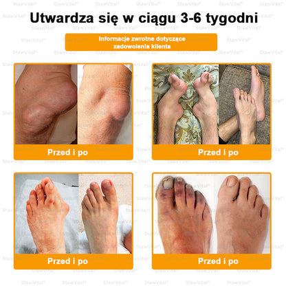 𝑺𝒕𝒂𝒘𝑽𝒊𝒕𝒂𝒍® Krem z jadem pszczelim na regenerację stawów 🏃‍♀️ (ekstrakt z pszczoły nowozelandzkiej – opracowany z myślą o osobach z problemami ze stawami i bólem stawów)