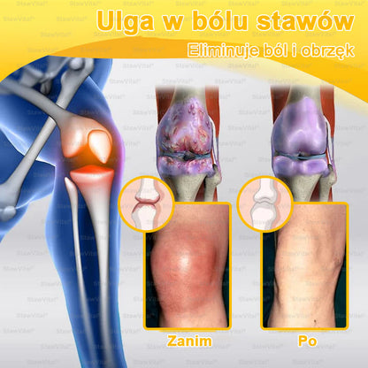 𝑺𝒕𝒂𝒘𝑽𝒊𝒕𝒂𝒍® Krem z jadem pszczelim na regenerację stawów 🏃‍♀️ (ekstrakt z pszczoły nowozelandzkiej – opracowany z myślą o osobach z problemami ze stawami i bólem stawów)