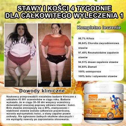 𝑺𝒕𝒂𝒘𝑽𝒊𝒕𝒂𝒍® 🦴 𝑲𝒓𝒆𝒎 𝒛 𝑱𝒂𝒅𝒆𝒎 𝑷𝒔𝒛𝒄𝒛𝒆𝒍𝒊𝒎 𝑳𝒆𝒄𝒛𝒏𝒊𝒄𝒛𝒚 𝒅𝒐 𝑹𝒆𝒈𝒆𝒏𝒆𝒓𝒂𝒄𝒋𝒊 𝑺𝒕𝒂𝒘ó𝒘 | 𝒆𝒌𝒔𝒕𝒓𝒂𝒌𝒕 𝒛 𝒑𝒔𝒛𝒄𝒛𝒐ł𝒚 𝒏𝒐𝒘𝒐𝒛𝒆𝒍𝒂𝒏𝒅𝒛𝒌𝒊𝒆𝒋 - 𝒘𝒚𝒔𝒑𝒆𝒄𝒋𝒂𝒍𝒊𝒛𝒐𝒘𝒂𝒏𝒚 𝒘 𝒍𝒆𝒄𝒛𝒆𝒏𝒊𝒖 𝒔𝒄𝒉𝒐𝒓𝒛𝒆ń 𝒐𝒓𝒕𝒐𝒑𝒆𝒅𝒚𝒄𝒛𝒏𝒚𝒄𝒉 𝒊 𝒃ó𝒍𝒖 𝒔𝒕𝒂𝒘ó𝒘